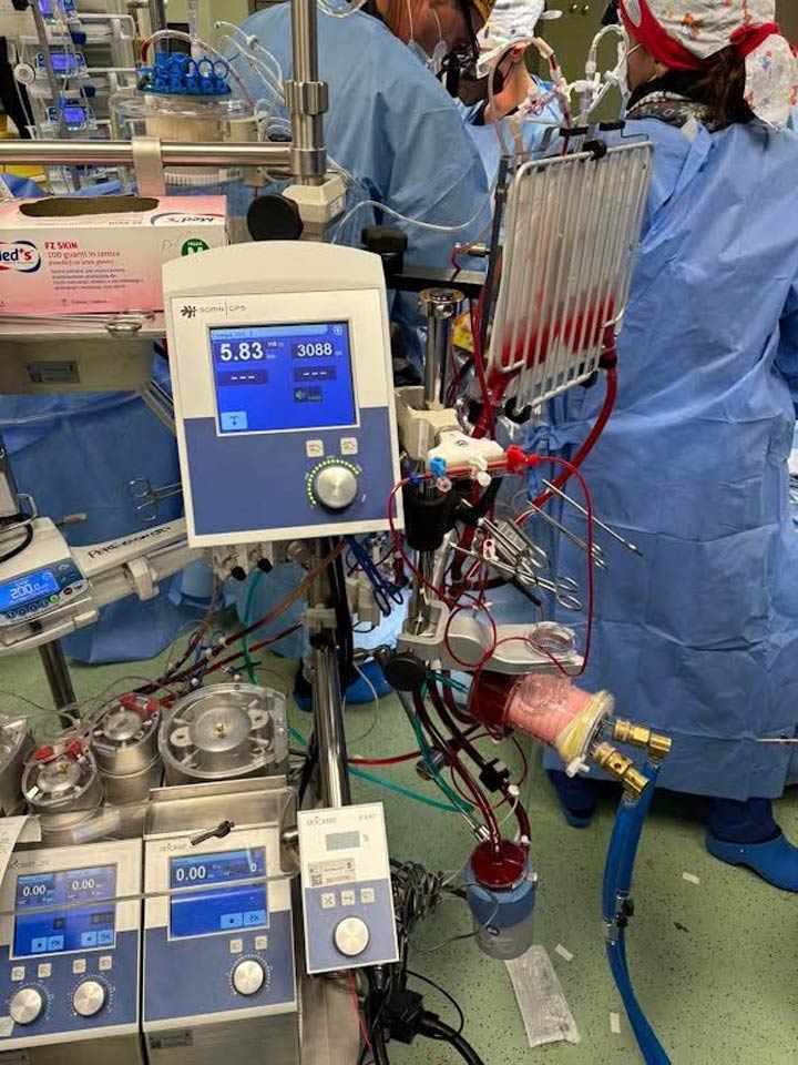 Alla Dulbecco avviato programma “mini-circolazione extracorporea”